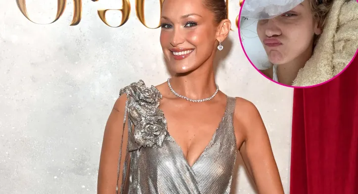 Podyum Işıklarının Ardındaki Acı Gerçek: Bella Hadid'in Lyme Savaşı ve Yürek Burkan Son Paylaşımı